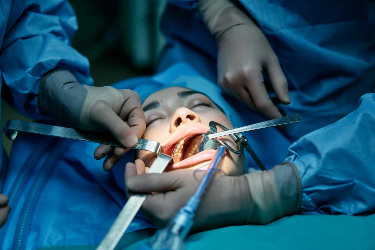 Oralna hirurgija